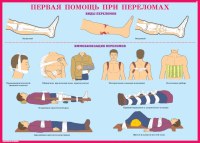 Комплект плакатов №5 «Первая медицинская помощь при чрезвычайных ситуациях», 10л., А3
