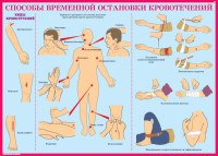 Комплект плакатов №5 «Первая медицинская помощь при чрезвычайных ситуациях», 10л., А3